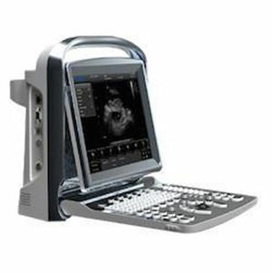 
                  
                    Chison ECO2 Portable Ultrasound & with Linear Array Probe, Battery Bag, Warranty
                  
                