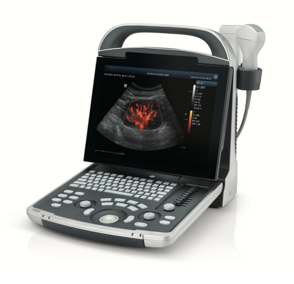 
                  
                    Affordable Color Doppler Ultrasound two probes Convex & Linear Array
                  
                