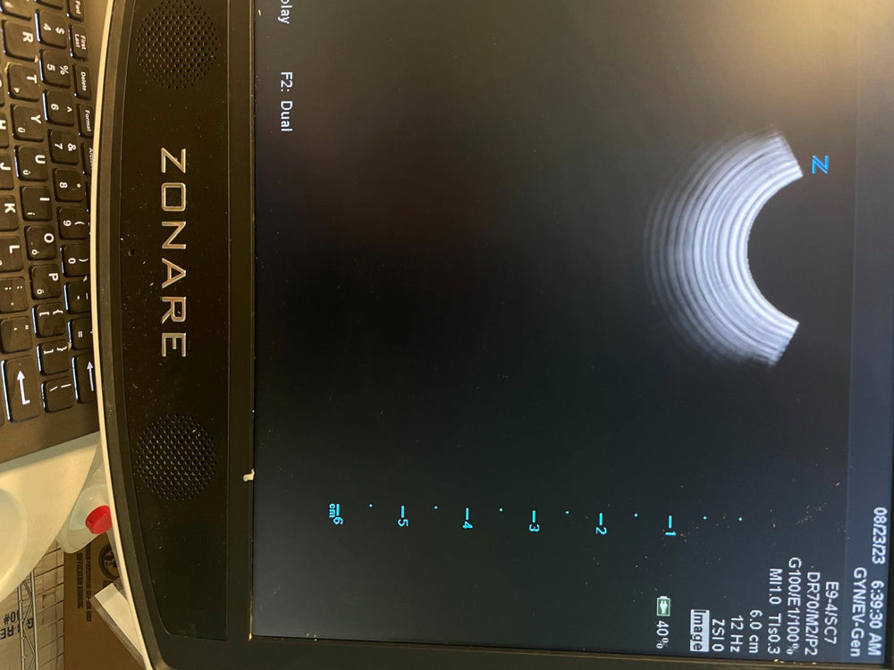 
                  
                    ZONARE E9-4 Ultrasound Probe Transducer
                  
                