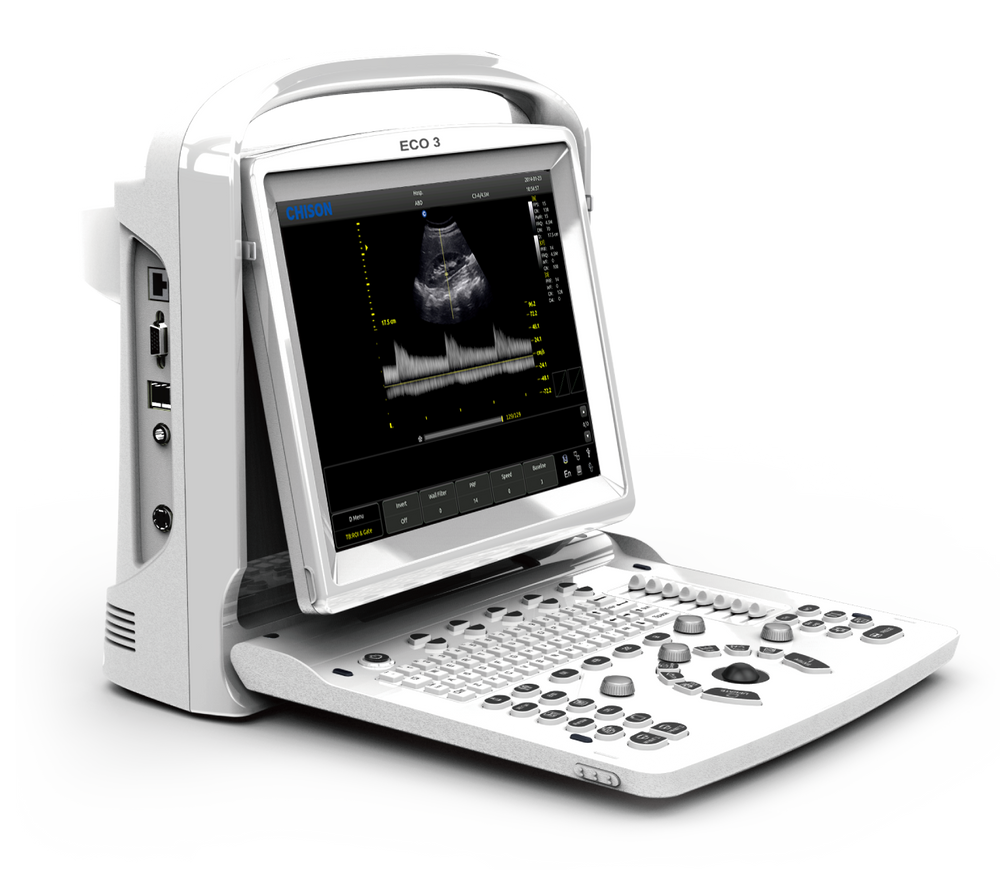 Are You The Owner Of A Clinic? Here Are Two Simple Reasons Why A Portable Ultrasound Machine Makes Sense For You.