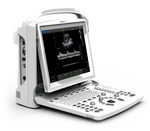 Are You The Owner Of A Clinic? Here Are Two Simple Reasons Why A Portable Ultrasound Machine Makes Sense For You.