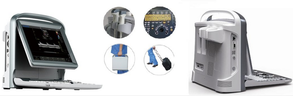 Chison ECO Series Ultrasounds