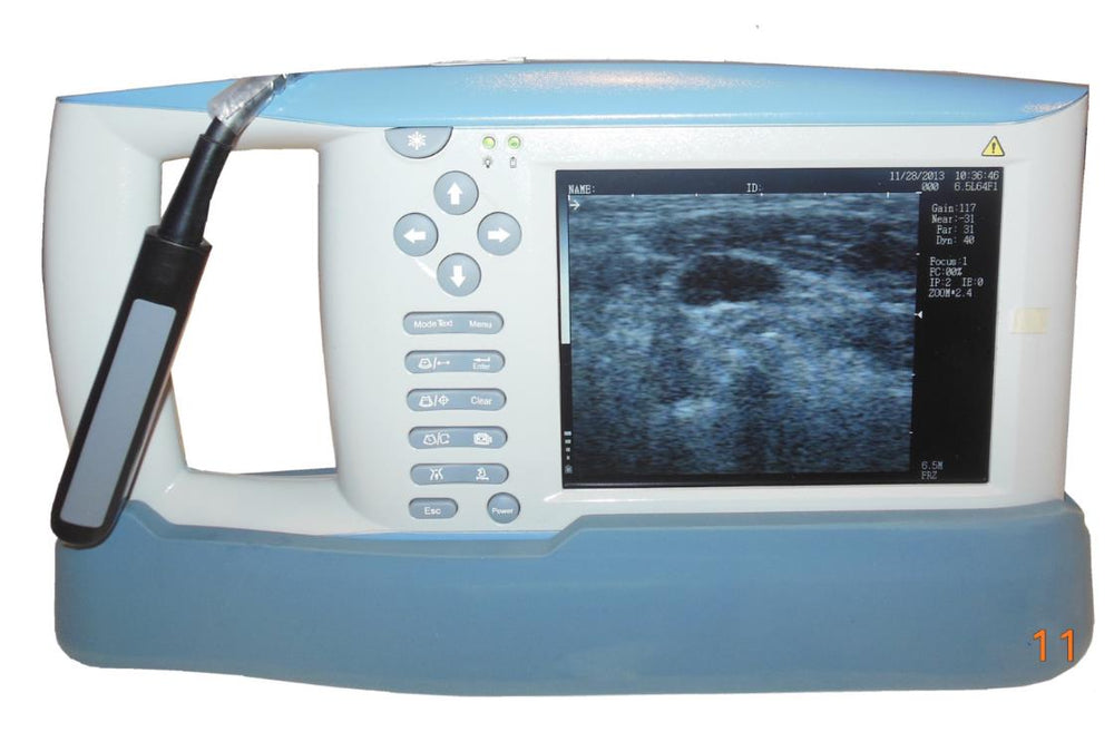 
                  
                    KX5100V and Rectal Arm
                  
                