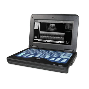 
                  
                    Portable Ultrasound Scanner Veterinary Pregnancy with 3.5 MHz Micro convex Probe
                  
                