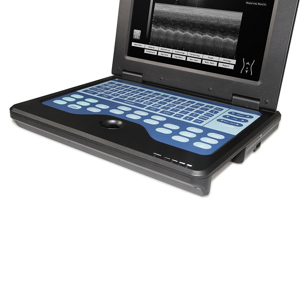 
                  
                    Portable Ultrasound Scanner Veterinary Pregnancy with 3.5 MHz Micro convex Probe
                  
                