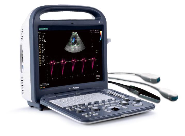 
                  
                    Used Sonoscape S2V Ultrasound
                  
                