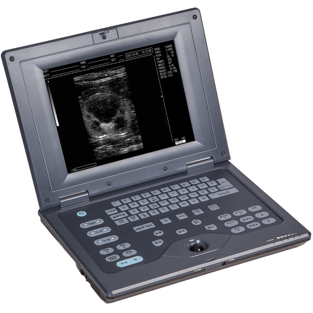 
                  
                    Bovine, Equine Laptop Ultrasound Machine & Rectal Probe - ECO-5000V | KeeboMed
                  
                
