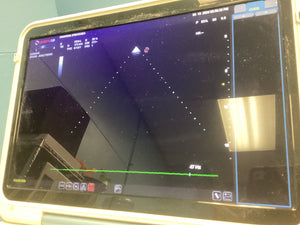 
                  
                    Cardiac Phased Array Esaote Probe SP2430 PROPBE  MyLab Alpha Ultrasound
                  
                