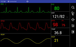 
                  
                    Handheld Bluetooth or USB Veterinary Patient Monitor Sub-System
                  
                