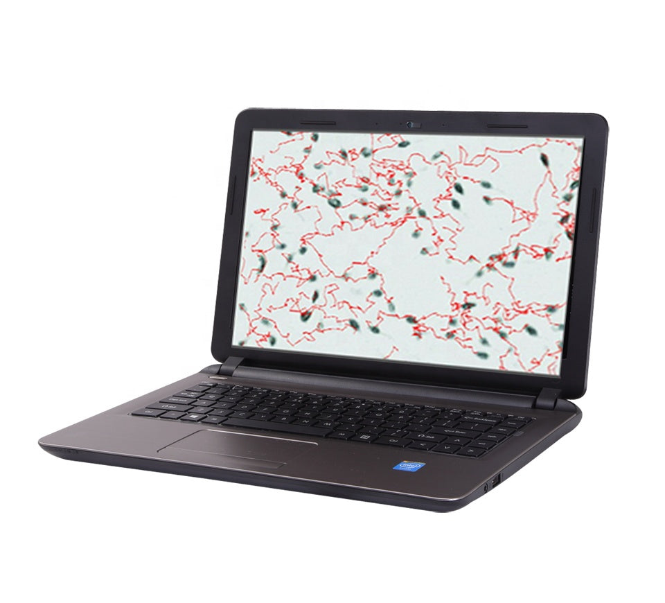 
                  
                    Canine Portable Semen Analyzer
                  
                