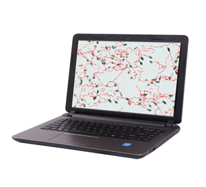 
                  
                    Canine Portable Semen Analyzer
                  
                