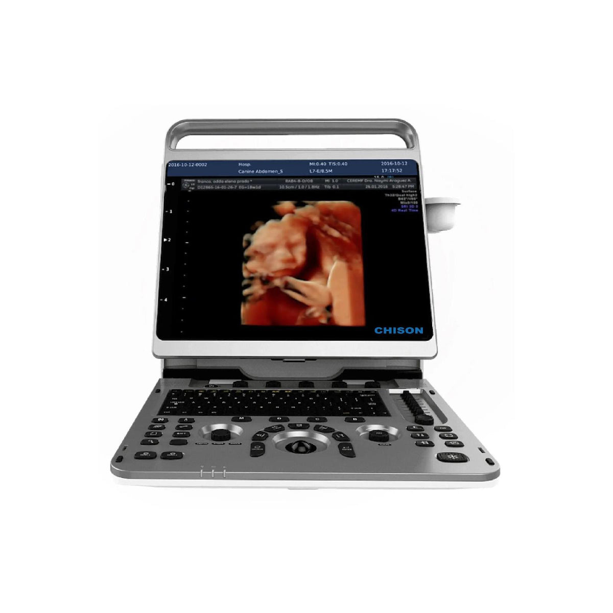 Chison EbIt30 Ultrasound with 4D and HD Function and Volumetric probe ...