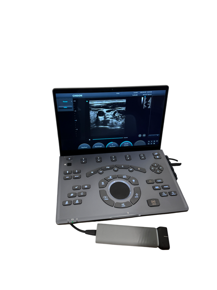 
                  
                    SonoAir
                  
                