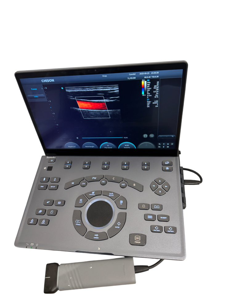 
                  
                    SonoAir
                  
                