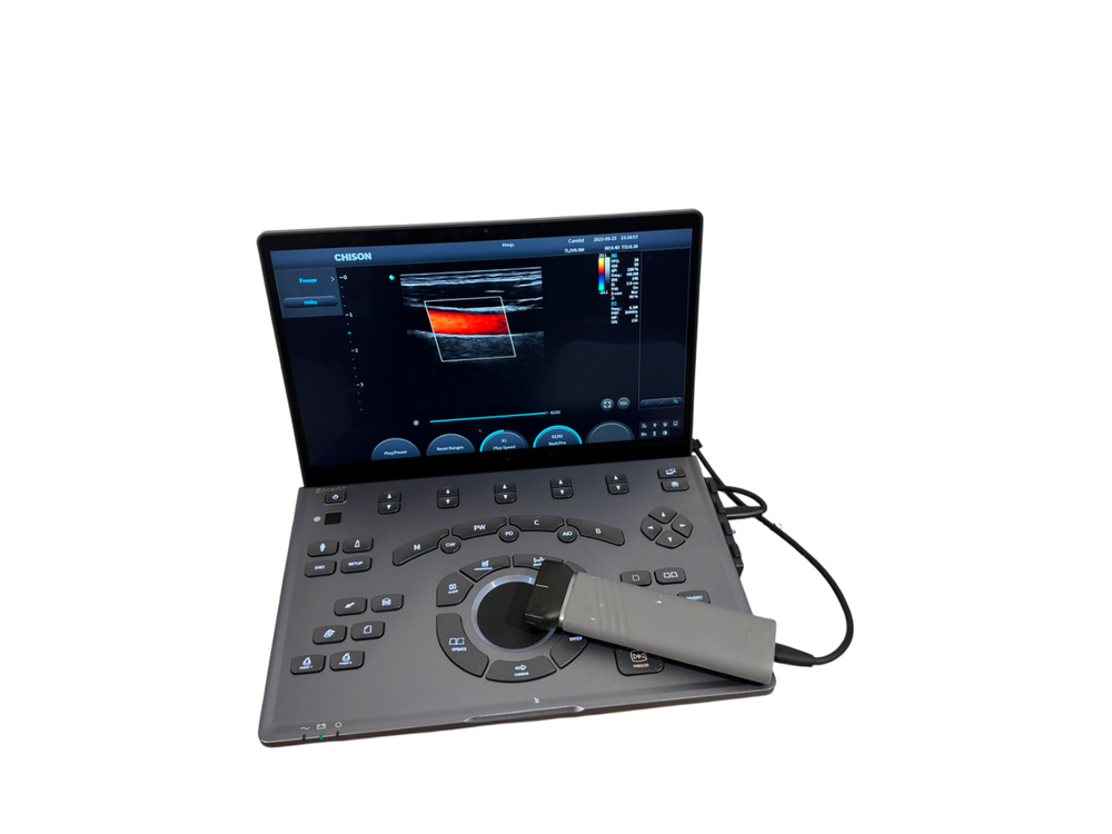 
                  
                    SonoAir
                  
                
