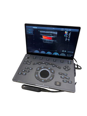 
                  
                    SonoAir
                  
                