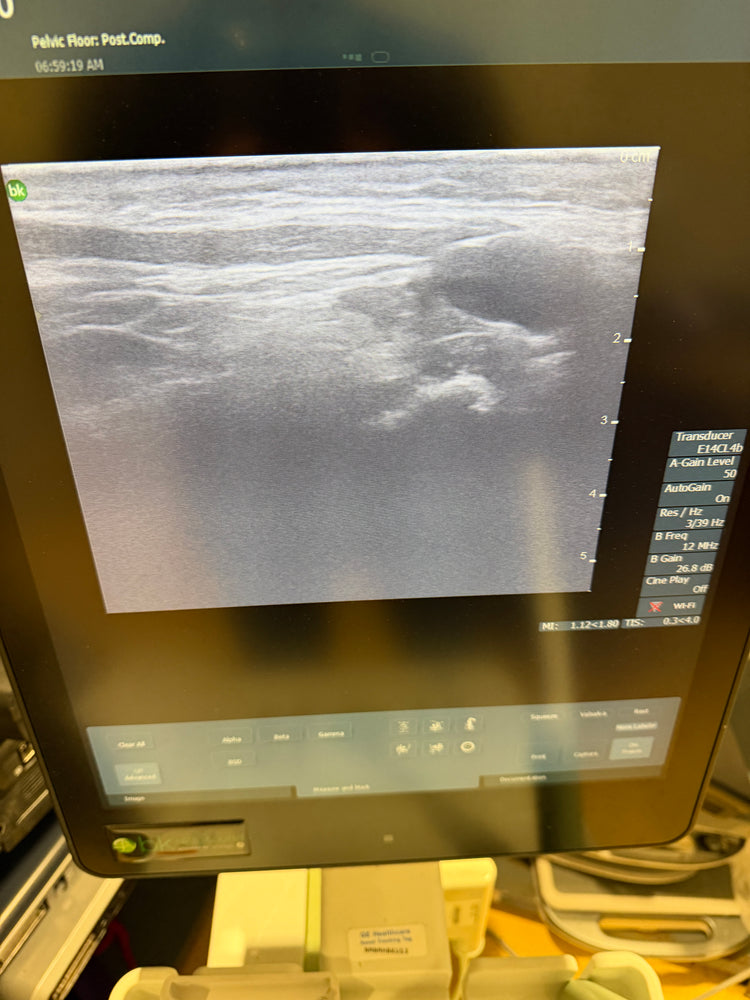 
                  
                    BK MEDICAL E14CL4B (9048) Ultrasound probe Transducer
                  
                