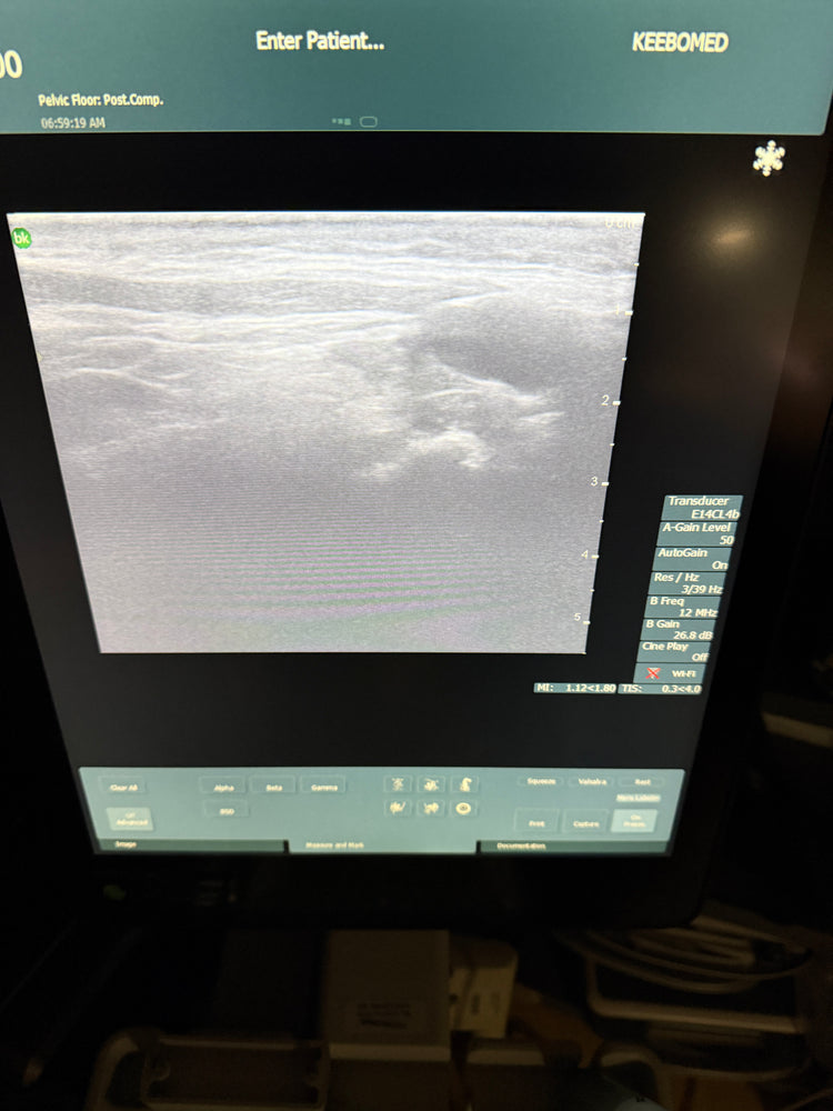 
                  
                    BK MEDICAL E14CL4B (9048) Ultrasound probe Transducer
                  
                