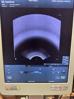 
                  
                    BK Medical Ultrasound Probe BK 8808e Endo Vaginal Transducer TV probe
                  
                