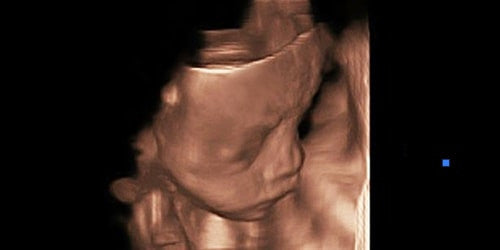Q9 Color Doppler 4D Fetal Head