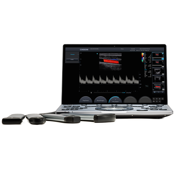 
                  
                    SonoAir
                  
                
