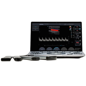
                  
                    SonoAir
                  
                