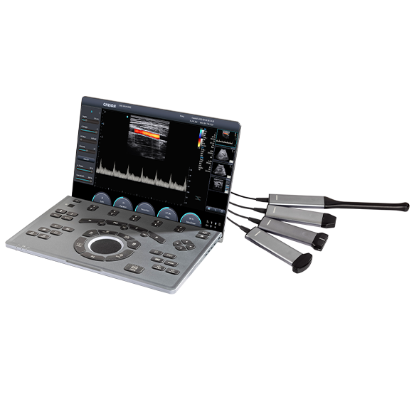 
                  
                    SonoAir
                  
                