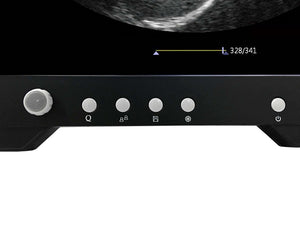 
                  
                    iSonoTouch 20V
                  
                