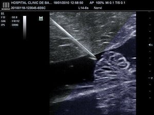 
                  
                    Mindray Advanced M7 CW 2018 Demo Model Ultrasound with 3 Probes, 3 Year Warranty
                  
                
