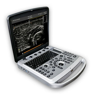 
                  
                    Chison Sonobook 6 Vet Color Doppler Ultrasound with Rectal Probe
                  
                