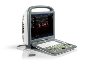 
                  
                    Sonoscape S2 Color Doppler Portable Ultrasound & Linear Array Probe L741 Demo
                  
                