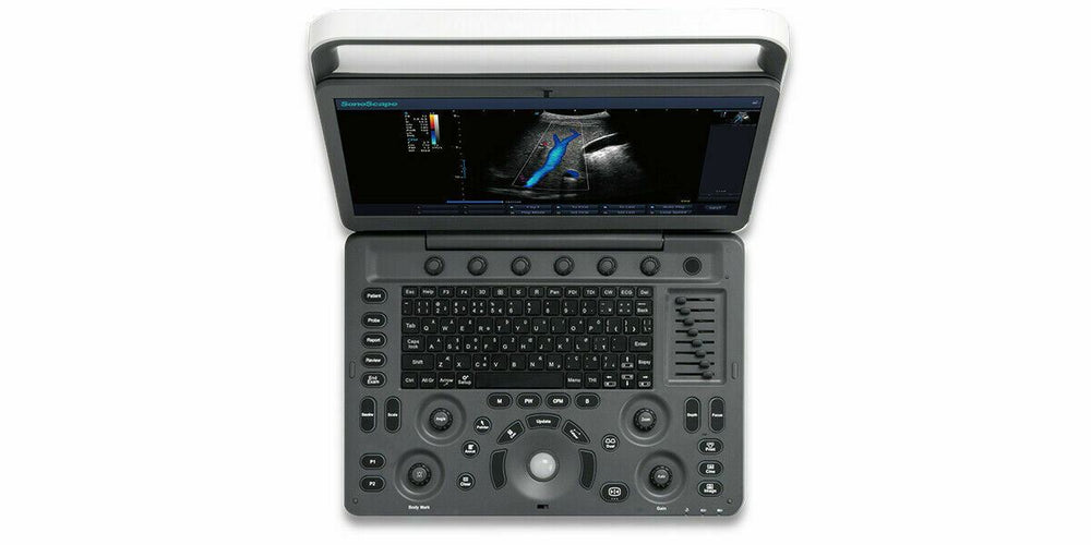 
                  
                    Demo SonoScape E2 Ultrasound with One Linear Array Probe
                  
                