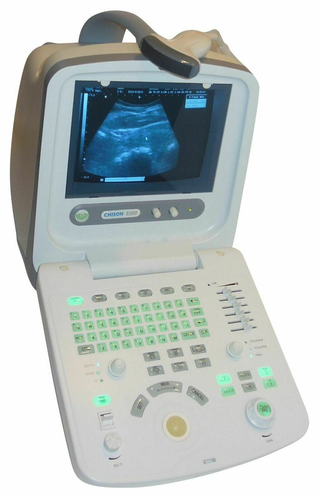 
                  
                    Best Deal Veterinary Ultrasound, Chison 8300Vet, Good Quality, Most Affordable
                  
                