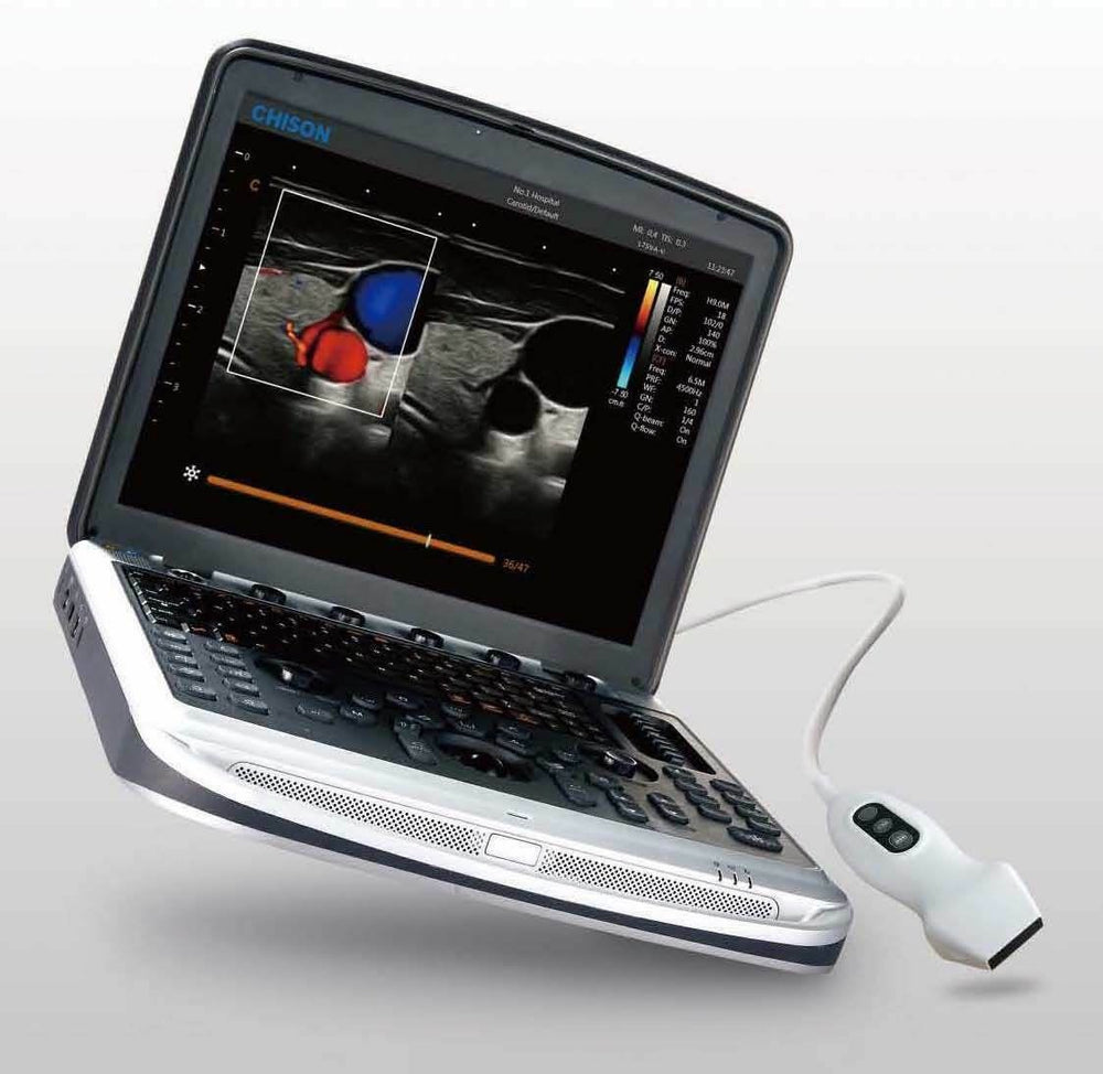 Chison Sonobook 8 Color Doppler Ultrasound with 2 probes cardiac ad vascular