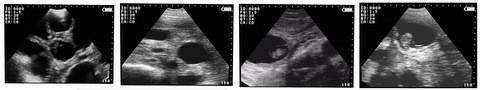 
                  
                    OviSonoSui 30Vet Handheld Ultrasound for Farm Animals
                  
                