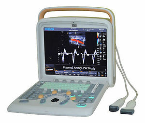 
                  
                    Ultrasound Chison Q5 with Trolley, 3 probes: Linear Array,Convex, TV and printer
                  
                