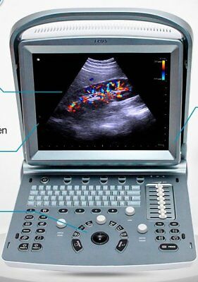 
                  
                    Refurbished Color Doppler Ultrasound  Chison ECO5 & Probe of Choice - Warranty
                  
                