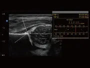 
                  
                    EBit10 Black & White Ultrasound | KeeboMed
                  
                