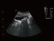 
                  
                    EBit10 Black & White Ultrasound | KeeboMed
                  
                