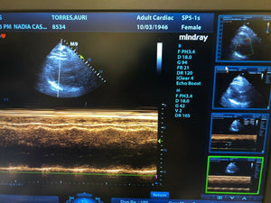 
                  
                    Mindray M9 Portable Ultrasound With 2 Probes
                  
                