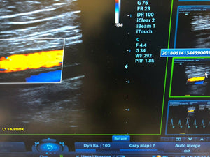 
                  
                    Mindray M9 Portable Ultrasound With  Two Probes (L12-4S) (C5-1S) DOM 2015
                  
                