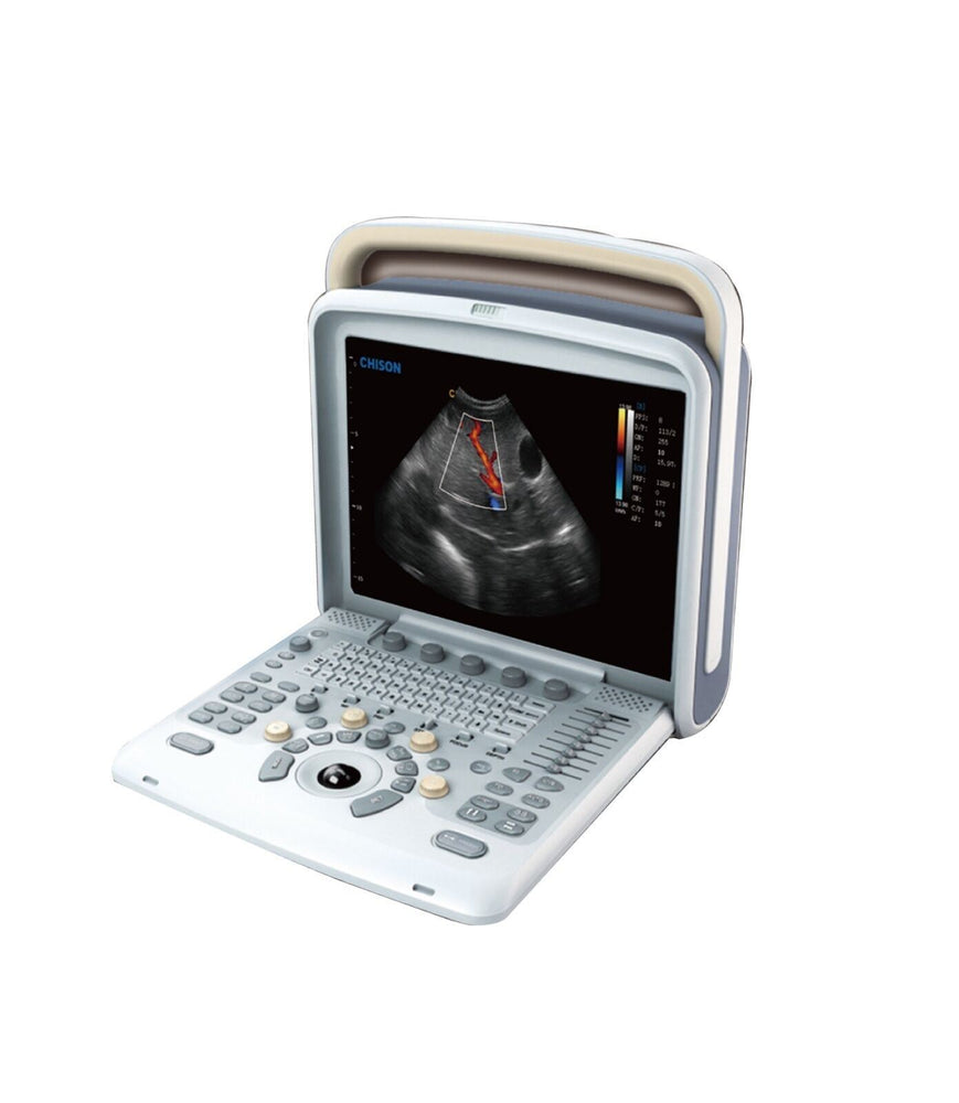 
                  
                    Chison Q5Vet Veterinary Color Doppler Ultrasound Machine, Equipment - Low Price
                  
                