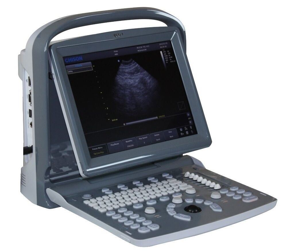 
                  
                    Chison ECO1 Portable Ultrasound Machine, Quality, LED, Linear & Printer Included
                  
                