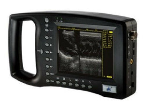 
                  
                    Handheld Palm Ultrasound Scanner WED-3100 With Linear Array Probe 6.5/.5/8.5MHz
                  
                