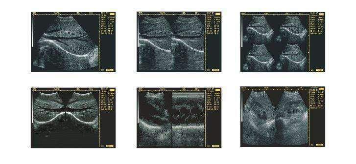
                  
                    Handheld Palm Ultrasound Scanner WED-3100 With Linear Array Probe 6.5/.5/8.5MHz
                  
                