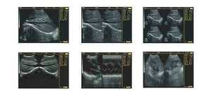 
                  
                    Handheld Palm Ultrasound Scanner WED-3100 With Linear Array Probe 6.5/.5/8.5MHz
                  
                