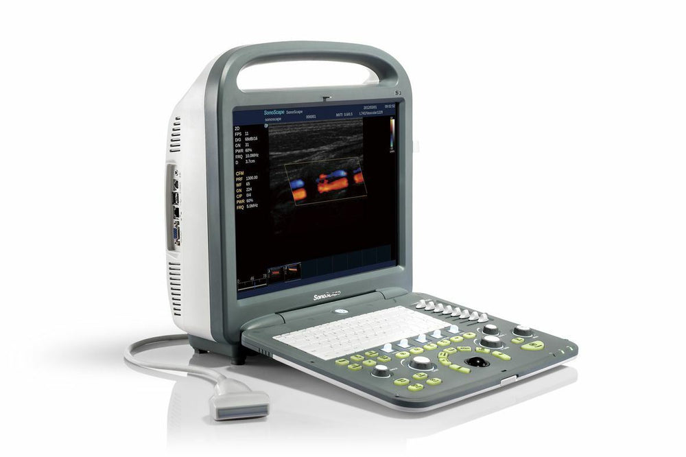 
                  
                    Sonoscape E2 Color Doppler portable ultrasound & Linear array probe L741
                  
                