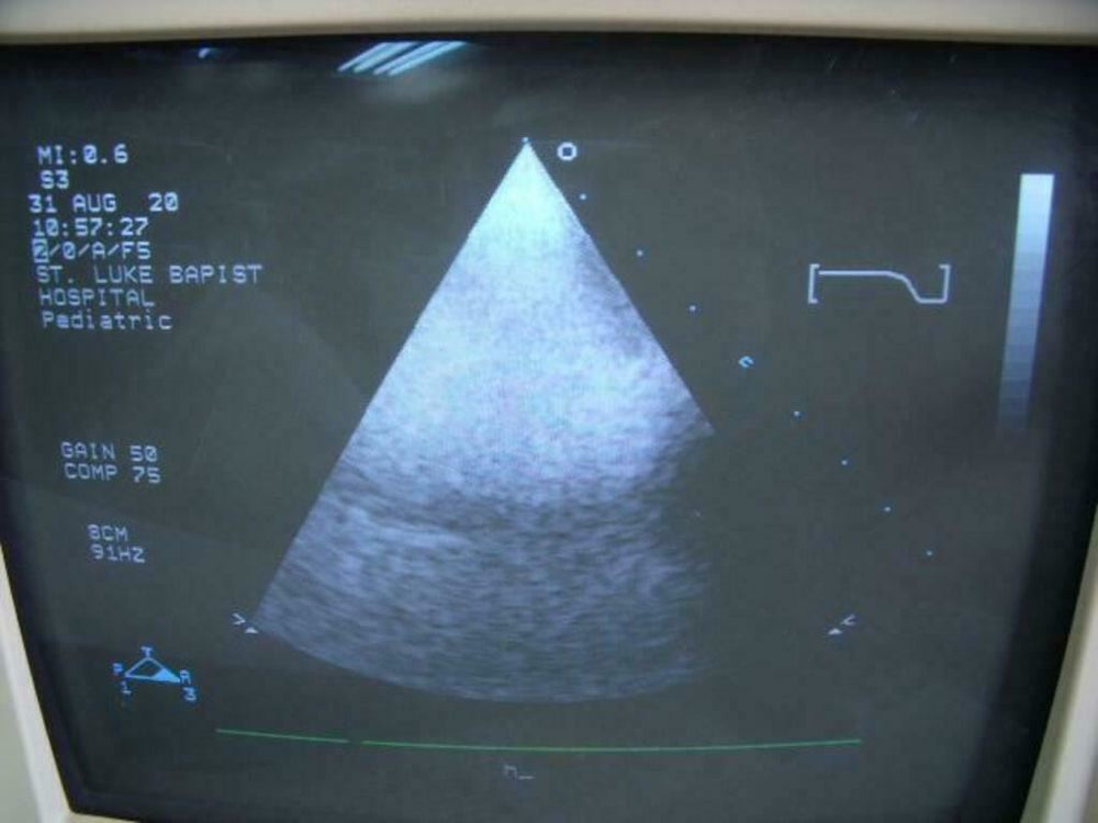 
                  
                    Philips 21311A S3 Ultrasound Probe | PR5323
                  
                