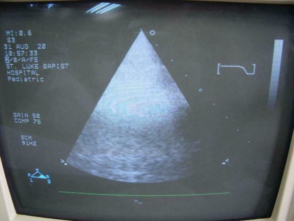 
                  
                    Philips 21311A S3 Ultrasound Probe | PR5323
                  
                