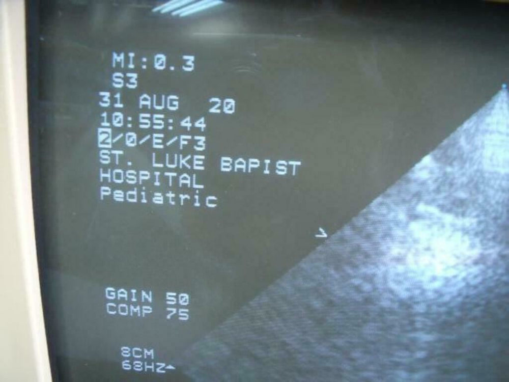 
                  
                    Philips 21311A S3 Ultrasound Probe | PR5323
                  
                